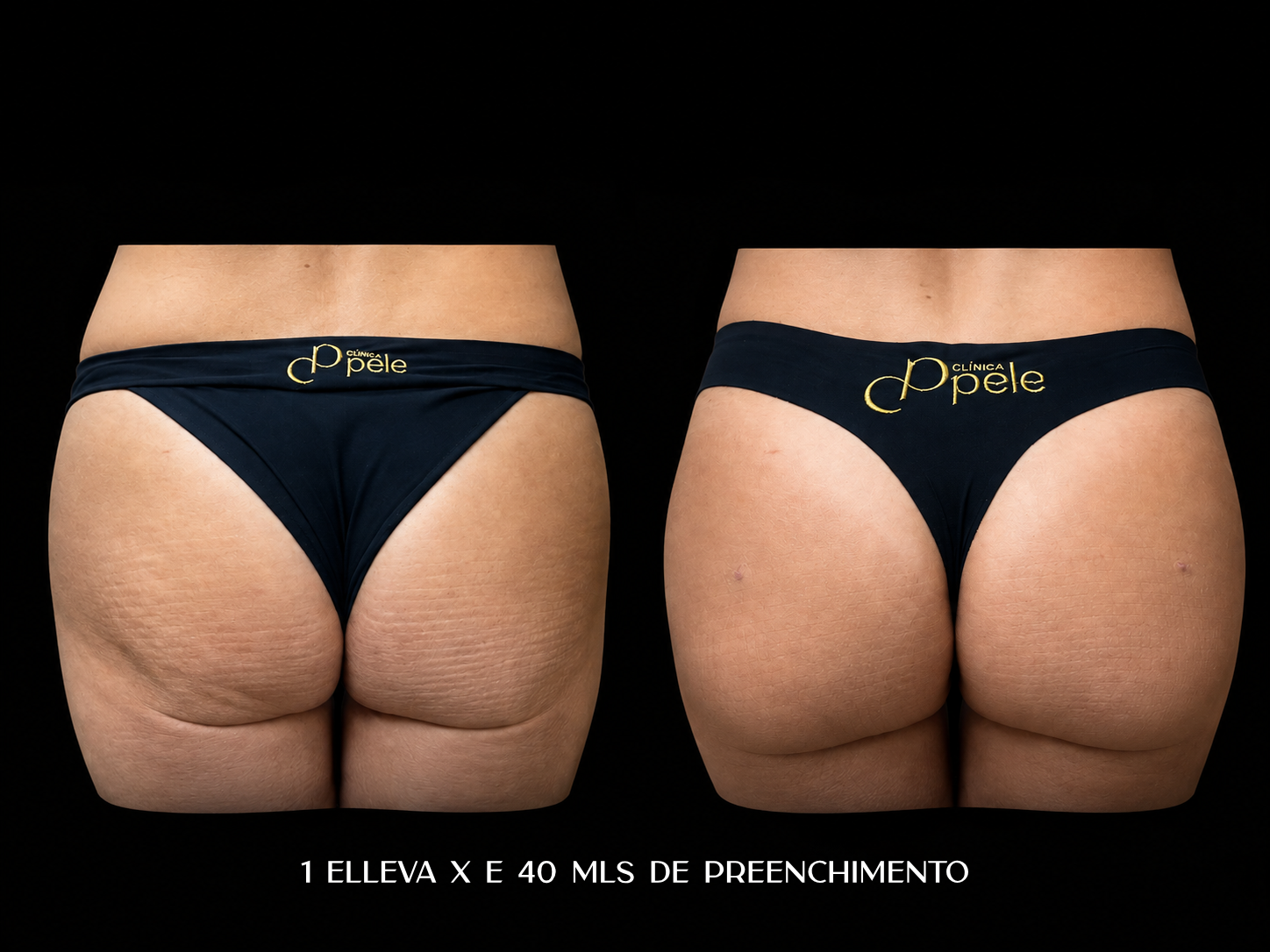 Imagem do slide