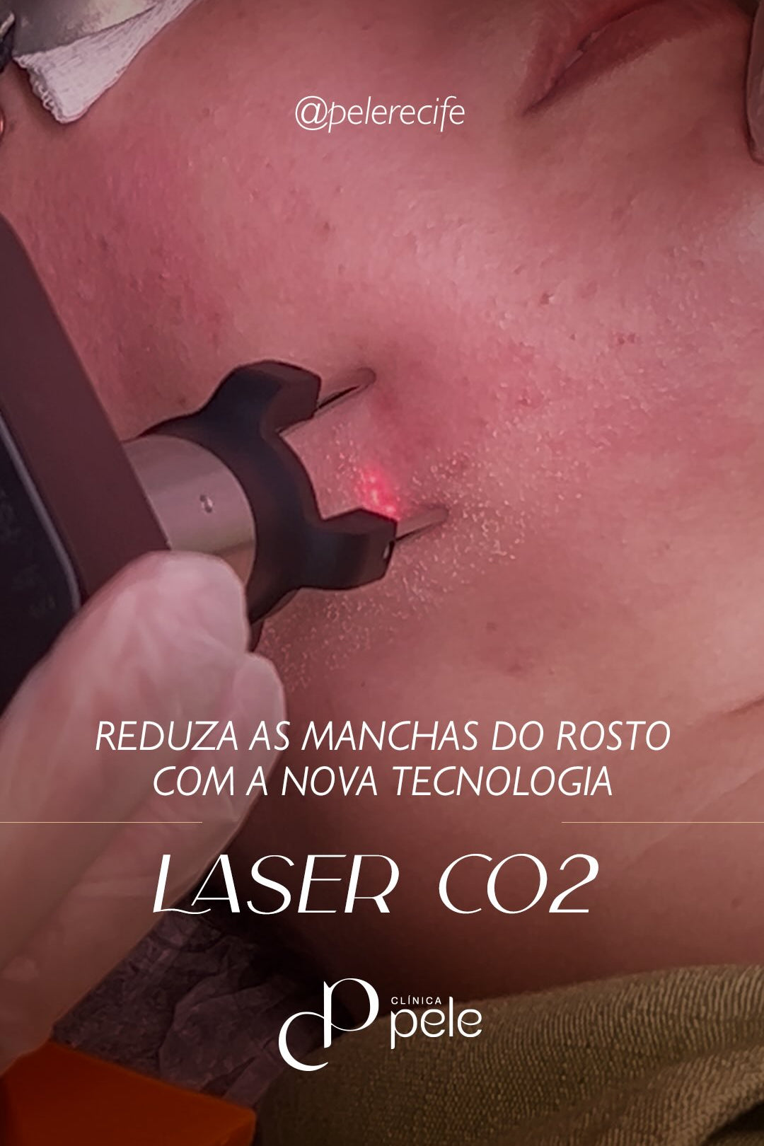 Imagem do slide